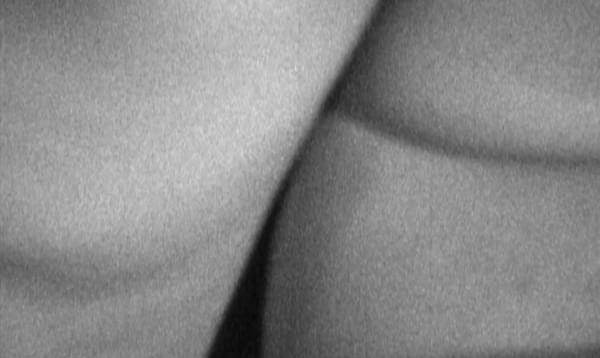 Black and white, close-up image of skin